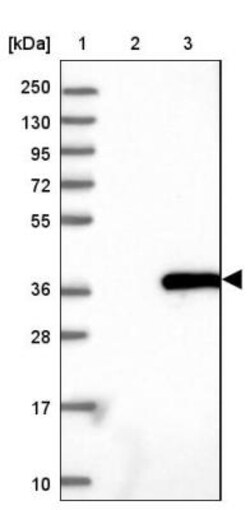 MIOX Antibody, Novus Biologicals 0.1mL; Unlabeled:Antibodies, Polyclonal