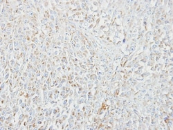 MIPEP Antibody, Novus Biologicals 0.1mL; Unlabeled:Antibodies, Polyclonal