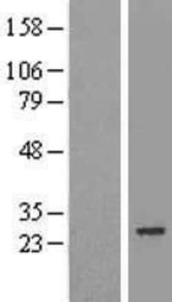 Novus Biologicals™ MIS12 Overexpression Lysate