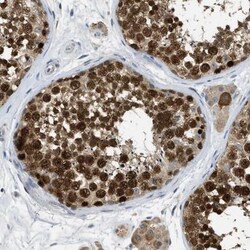 MIS18A Antibody, Novus Biologicals 0.1mL; Unlabeled:Antibodies, Polyclonal