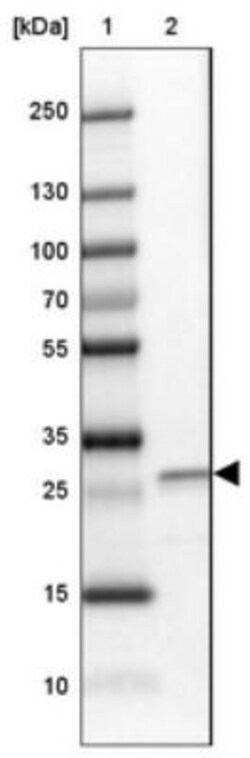 MIS18A Antibody, Novus Biologicals 0.1mL; Unlabeled:Antibodies, Polyclonal