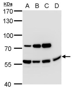 MIS/AMH Antibody, Novus Biologicals 0.1mL:Antibodies, Polyclonal