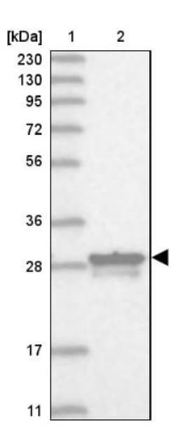 MITD1 Antibody, Novus Biologicals 0.1mL; Unlabeled:Antibodies, Polyclonal