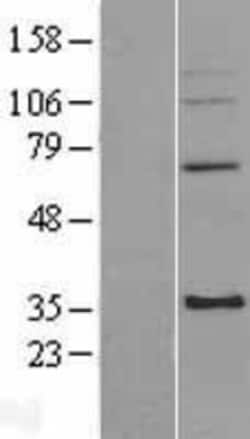 Novus Biologicals™ mitochondrial ribosomal protein L4 Overexpression Lysate