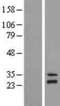 Novus Biologicals™ mitochondrial ribosomal protein L4 Overexpression Lysate