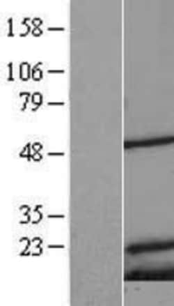 Novus Biologicals Mitochondrial Ribosomal Protein S18C Overexpression Lysate