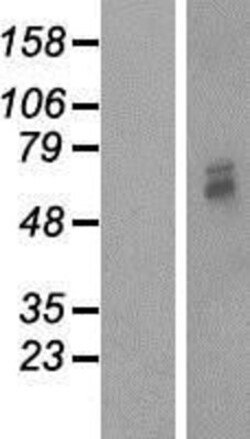 Novus Biologicals&trade;&nbsp;Mitochondrial-processing peptidase subunit beta Overexpression Lysate