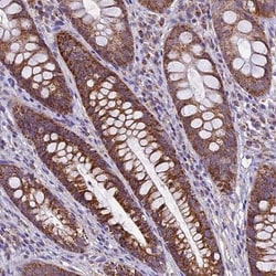 Mitochondrial-processing peptidase subunit beta Antibody, Novus Biologicals
