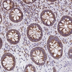 Mitochondrial ribosomal protein L11 Antibody, Novus Biologicals:Antibodies:Primary