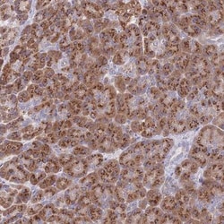 mitochondrial ribosomal protein L30 Antibody, Novus Biologicals 25 &mu;L,