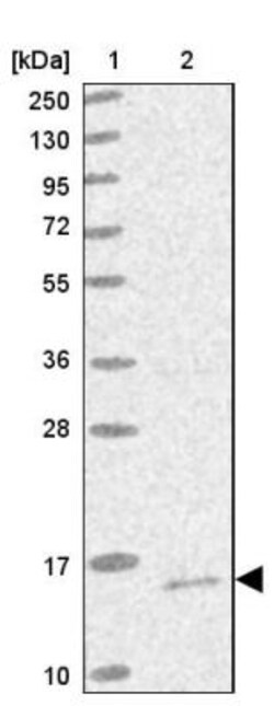 Mitochondrial Ribosomal Protein S18C Antibody, Novus Biologicals:Antibodies:Primary
