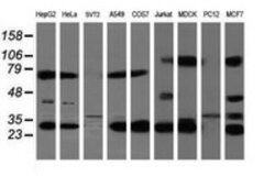 Mitocondrial Translational Initiation Factor 3 Antibody (OTI4B6), Novus