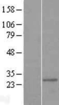Novus Biologicals&trade;&nbsp;Mitocondrial Translational Initiation Factor 3 Overexpression Lysate