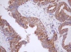 Mitocondrial Translational Initiation Factor 3 Antibody (OTI4B6), Novus