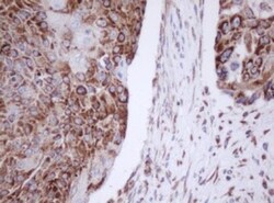 Mitocondrial Translational Initiation Factor 3 Antibody (OTI4B6), Novus