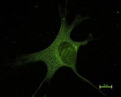 Mitofusin 1 Antibody - BSA Free, Novus Biologicals 0.1mL; Unlabeled:Antibodies,