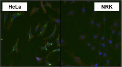 MKK4/MEK4 Antibody (2 E4), Novus Biologicals 0.1mg; Unlabeled:Antibodies,