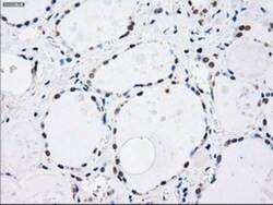 MKK4/MEK4 Antibody (OTI8A8), Novus Biologicals 0.1mL; Unlabeled:Antibodies,