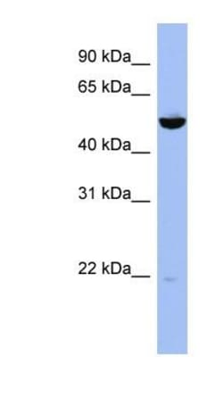 MKK7/MEK7 Antibody, Novus Biologicals 100&mu;L; Unlabeled:Antibodies, Polyclonal
