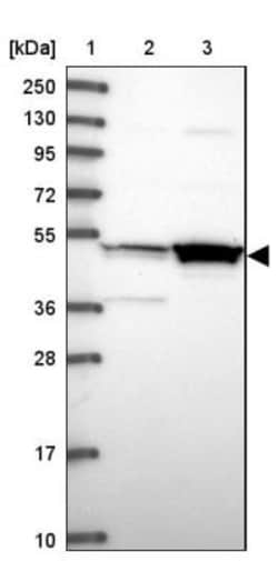 MKKS Antibody, Novus Biologicals 0.1mL; Unlabeled:Antibodies, Polyclonal