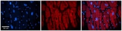 MKLP1 Antibody, Novus Biologicals 100μL; Unlabeled:Antibodies, Polyclonal