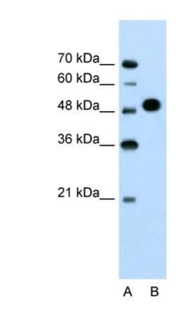 MKRN1 Antibody, Novus Biologicals 0.1mg; Unlabeled:Antibodies, Polyclonal