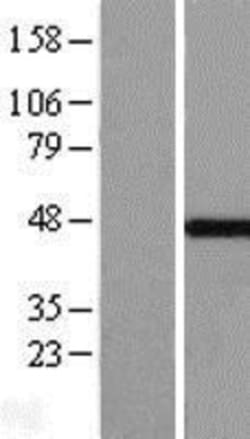 Novus Biologicals™ MKRN2 Overexpression Lysate