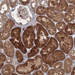 MKRN2 Antibody, Novus Biologicals:Antibodies:Primary Antibodies