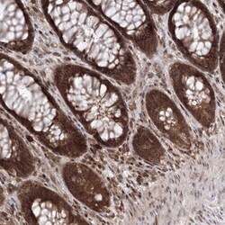 MKRN2 Antibody, Novus Biologicals 0.1mL; Unlabeled:Antibodies, Polyclonal