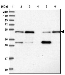 MKRN2 Antibody, Novus Biologicals 0.1mL; Unlabeled:Antibodies, Polyclonal