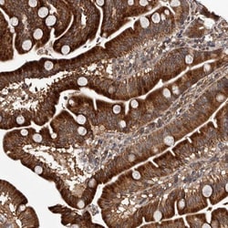 MKRN3 Antibody, Novus Biologicals 0.1mL; Unlabeled:Antibodies, Polyclonal