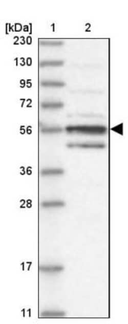 MKRN3 Antibody, Novus Biologicals 0.1mL; Unlabeled:Antibodies, Polyclonal