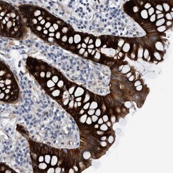 MKS1 Antibody, Novus Biologicals:Antibodies:Primary Antibodies