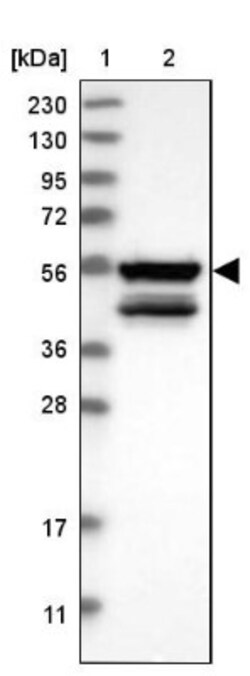 MKS1 Antibody, Novus Biologicals:Antibodies:Primary Antibodies