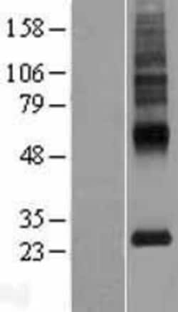 Novus Biologicals&trade;&nbsp;MLC1 Overexpression Lysate
