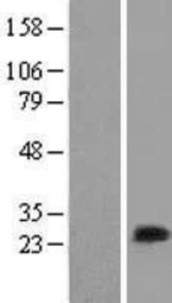 Novus Biologicals&trade;&nbsp;MLC1SA Overexpression Lysate