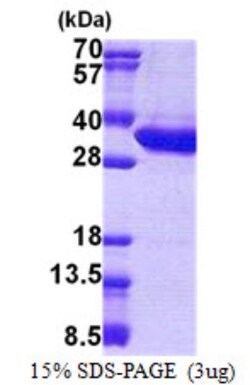Novus Biologicals&trade;&nbsp;Recombinant Human MLEC His Protein