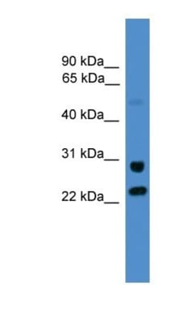 MLEC Antibody, Novus Biologicals:Antibodies:Primary Antibodies