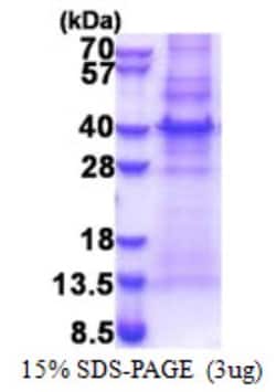 Novus Biologicals&trade;&nbsp;Recombinant Human MLF1 Interacting Protein His Protein