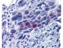 MLF1 Interacting Protein, p Thr78 Antibody, Novus Biologicals 0.1mg; Unlabeled:Antibodies,