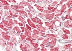 MLF1 Interacting Protein Antibody - N-terminal, Novus Biologicals 0.1mg;