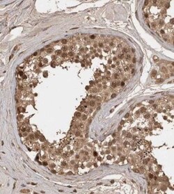MLF1 Interacting Protein Antibody, Novus Biologicals:Antibodies:Primary