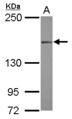 MLH3 Antibody, Novus Biologicals 0.1 mL | Buy Online | Novus Biologicals | Fisher Scientific