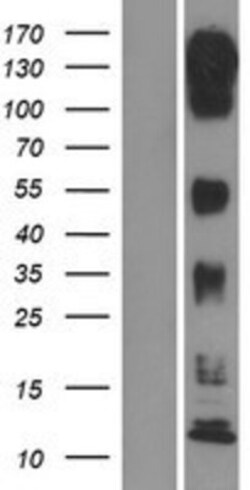 Novus Biologicals&trade;&nbsp;MLK3 Overexpression Lysate