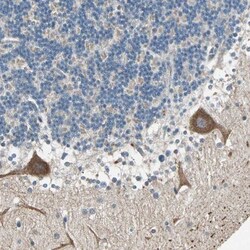 MLK4 Antibody, Novus Biologicals:Antibodies:Primary Antibodies