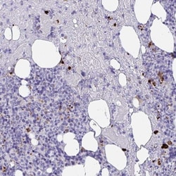 MLL5 Antibody, Novus Biologicals 0.1mL; Unlabeled:Antibodies, Polyclonal