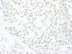 MLLT1 Antibody, Novus Biologicals 0.1mL; Unlabeled:Antibodies, Polyclonal