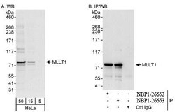 MLLT1 Antibody, Novus Biologicals 0.1mL; Unlabeled:Antibodies, Polyclonal