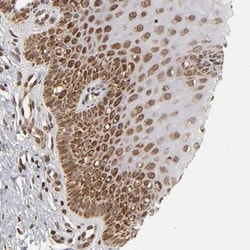 MLLT6 Antibody, Novus Biologicals 25 &mu;L | Buy Online | Novus Biologicals | Fisher Scientific