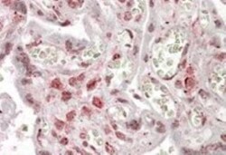 MLX Antibody, Novus Biologicals 0.1mg; Unlabeled:Antibodies, Polyclonal